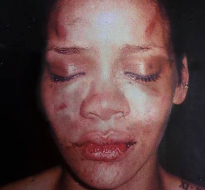 rihanna blessée par Chris Brown en 2009